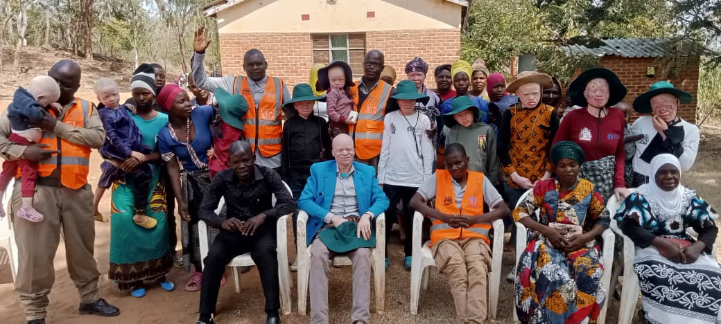 MACHINGA POLICE ADVISE PEOPLE WITH ALBINISM TO AVOID WALKING AT NIGHT
